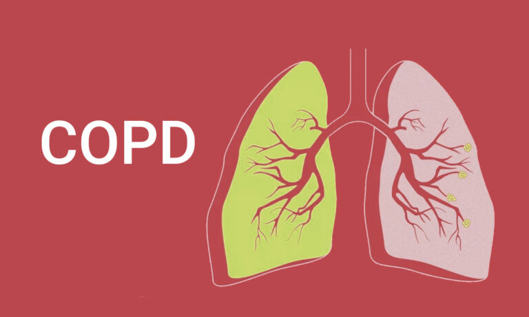 COPD és Buteyko légzés